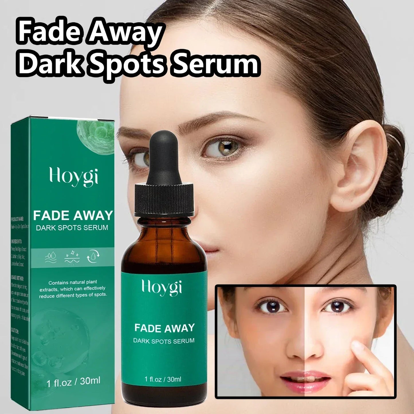 NNEOBA Dark Spot Remover Serum - Targets Sun Spots, Melasma, Freckles